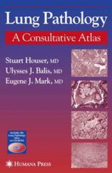 Lung Pathology: A Consultative Atlas