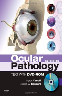 Ocular Pathology, 6Th Edition  