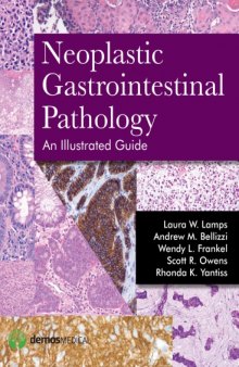 Neoplastic Gastrointestinal Pathology