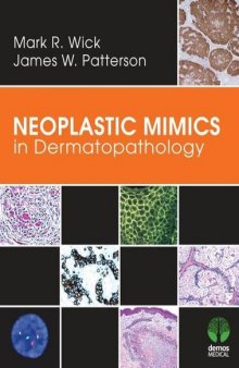 Neoplastic Mimics in Dermatopathology