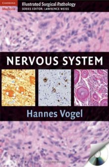 Nervous System (Cambridge Illustrated Surgical Pathology)