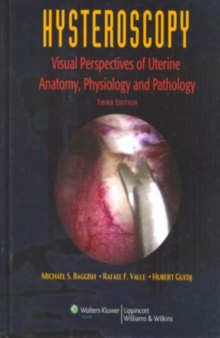 Hysteroscopy : visual perspectives of uterine anatomy, physiology and pathology