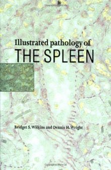 Illustrated Pathology of the Spleen  