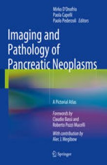 Imaging and Pathology of Pancreatic Neoplasms: A Pictorial Atlas