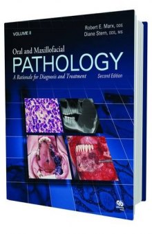 Oral and Maxillofacial Pathology: A Rationale for Diagnosis and Treatment