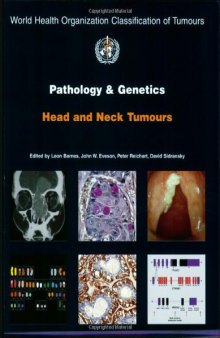 Pathology And Genetics of Head and Neck Tumours (World Health Organization Classification of Tumours)