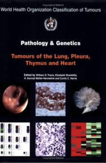 Pathology and Genetics of Tumours of the Lung, Pleura, Thymus and Heart (WORLD HEALTH ORGANIZATION CLASSIFICATION OF TUMOURS)