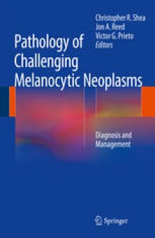 Pathology of Challenging Melanocytic Neoplasms: Diagnosis and Management