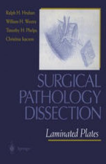 Surgical Pathology Dissection: Laminated Plates