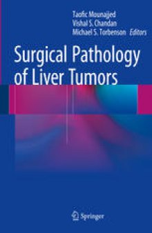 Surgical Pathology of Liver Tumors