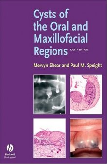 Cysts of the Oral and Maxillofacial Regions, 4th Edition