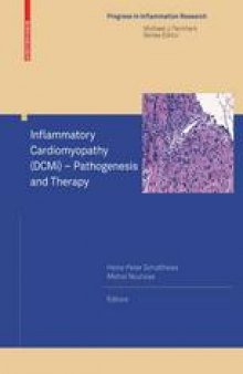Inflammatory Cardiomyopathy (DCMi): Pathogenesis and Therapy