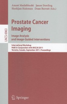 Prostate Cancer Imaging. Image Analysis and Image-Guided Interventions: International Workshop, Held in Conjunction with MICCAI 2011, Toronto, Canada, September 22, 2011. Proceedings