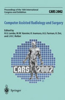 CARS 2002 Computer Assisted Radiology and Surgery: Proceedings of the 16th International Congress and Exhibition Paris, June 26–29,2002