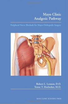 Mayo Clinic Analgesic Pathway: Peripheral Nerve Blockade for Major Orthopedic Surgery