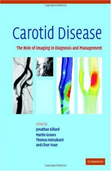Carotid Disease: The Role of Imaging in Diagnosis and Management