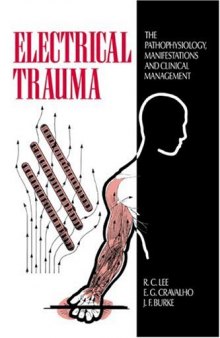 Electrical Trauma: The Pathophysiology, Manifestations and Clinical Management