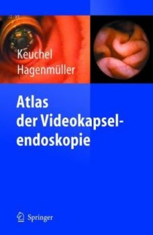 Atlas der Videokapselendoskopie 