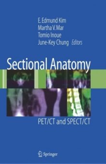 Sectional Anatomy: PET CT and SPECT CT