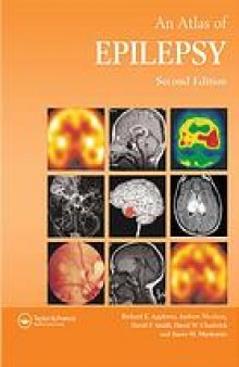 Atlas of epilepsy