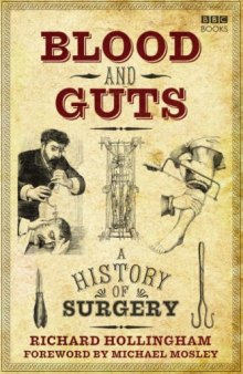 Blood and guts: A history of surgery