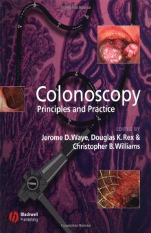 Colonoscopy: Principles and Practice 1st ed