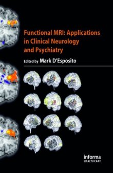 Functional MRI: Applications in Clinical Neurology and Psychiatry
