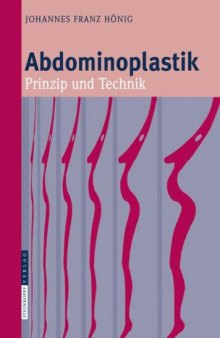 Abdominoplastik: Prinzip und Technik (German Edition)