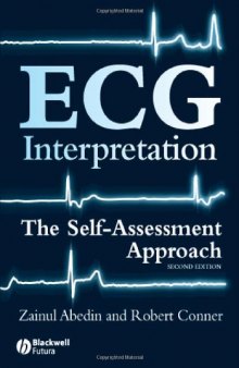 ECG Interpretation: The Self-Assessment Approach