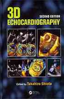 3D Echocardiography