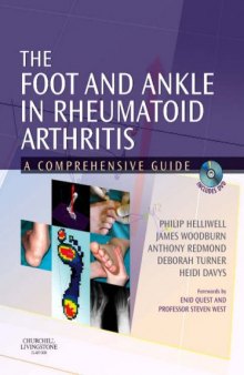 The Foot and Ankle in Rheumatoid Arthritis: A Comprehensive Guide