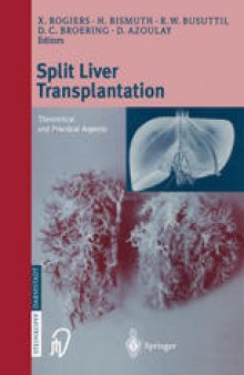 Split liver transplantation: Theoretical and practical aspects