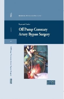 Off Pump Coronary Artery Bypass Surgery 