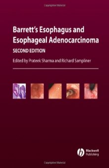 Barrett's Esophagus and Esophageal Adenocarcinoma (Second Edition)  