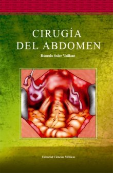 Cirugia del Abdomen  