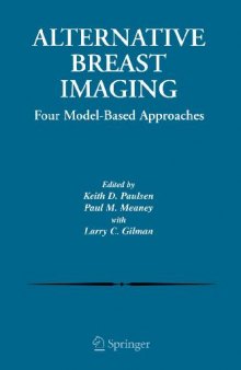 Alternative Breast Imaging Four Model-Based Approaches