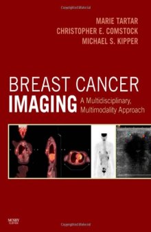 Breast Cancer Imaging: A Multidisciplinary, Multimodality Approach