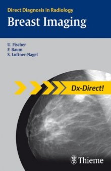 Breast imaging ( DX-Direct )  
