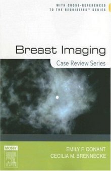 Breast Imaging: Case Review Series  