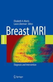 Breast MRI Diagnosis and Intervention