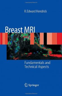 Breast MRI Fundamentals and Technical Aspects