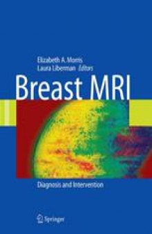 Breast MRI: Diagnosis and Intervention