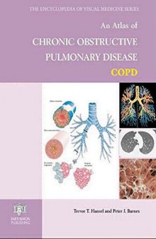 An atlas of chronic obstructive pulmonary disease, COPD