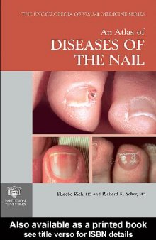 An Atlas of Deseases of the Nail