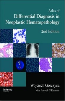 An Atlas of Differential Diagnosis in Neoplastic Hematopathology