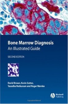 Bone Marrow Diagnosis: An Illustrated Guide 2nd Edition