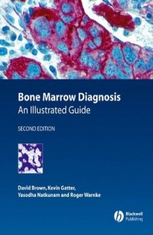 Bone Marrow Diagnosis: An Illustrated Guide, Second Edition