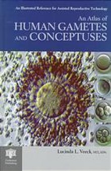 An atlas of human gametes and conceptuses : an illustrated reference for assisted reproductive technology
