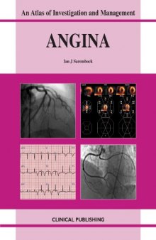 Angina: An Atlas of Investigation and Management