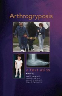 Arthrogryposis: a text atlas  